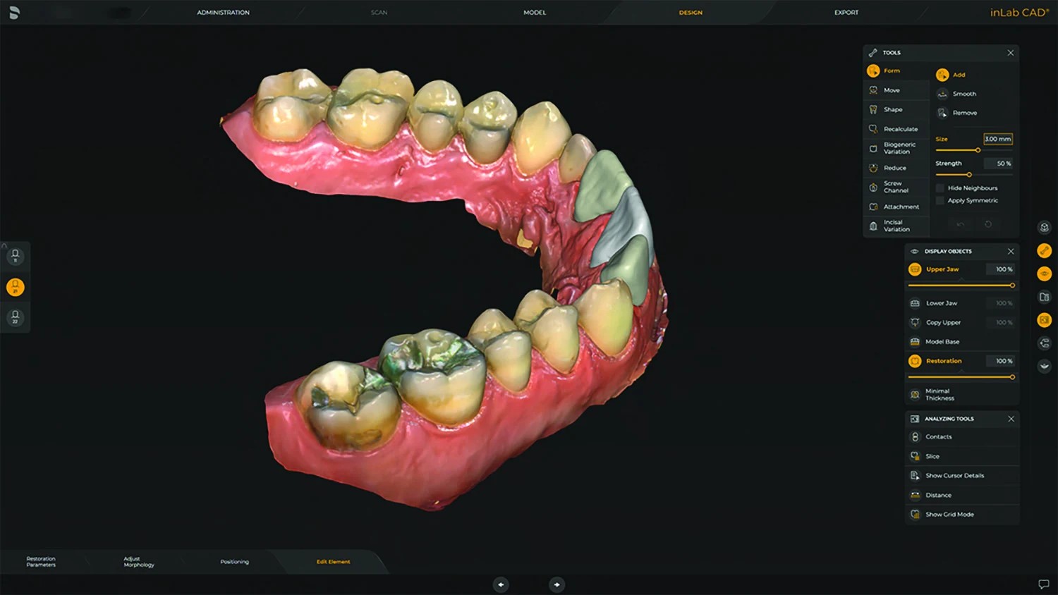 Virtual dental restoration design